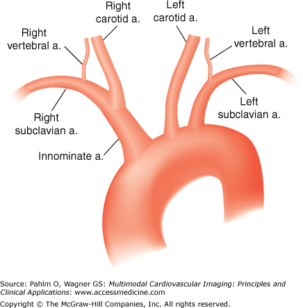 aortic root anatomy