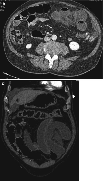 B | Radiology Key