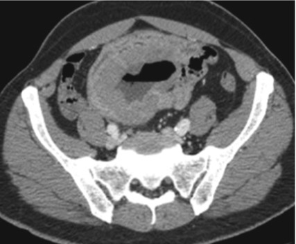 G | Radiology Key