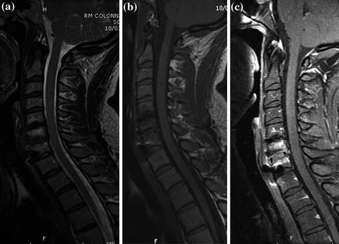 Herniated Cervical Disk Anterior Diskectomy 