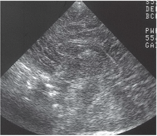 Pediatrics | Radiology Key