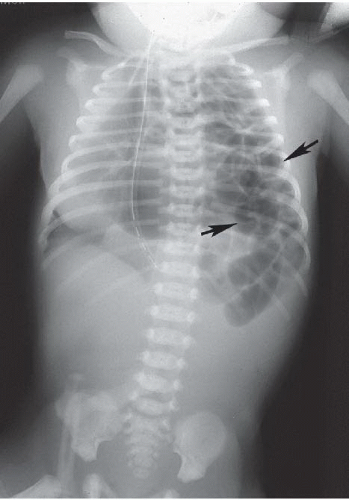 Pediatrics | Radiology Key