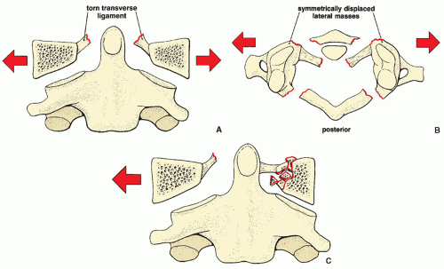 Spine Radiology Key