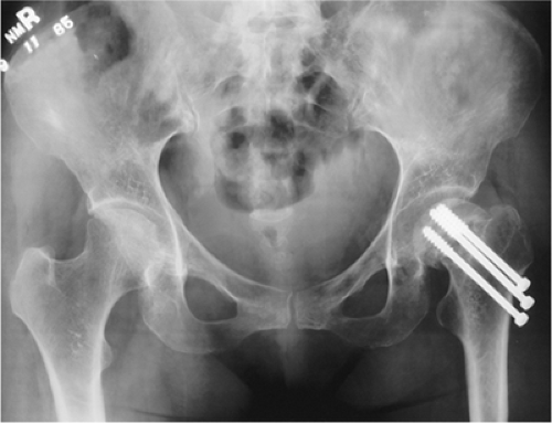 Miscellaneous Conditions | Radiology Key