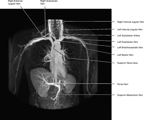 Upper Limb Veins Anatomy