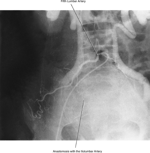 Abdominal Aorta And Branches Radiology Key