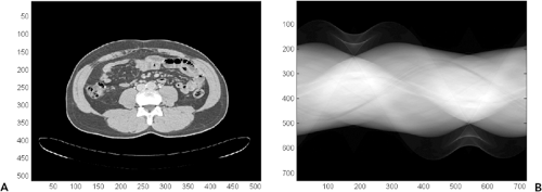 Basic Principles Of Computed Tomography Physics And Technical ...