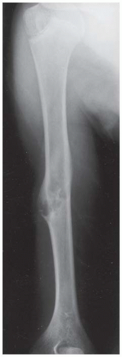 Elbow, Arm, and Shoulder | Radiology Key