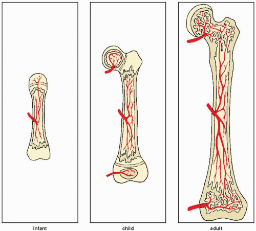 Radiologic Evaluation of Musculoskeletal Infections | Radiology Key