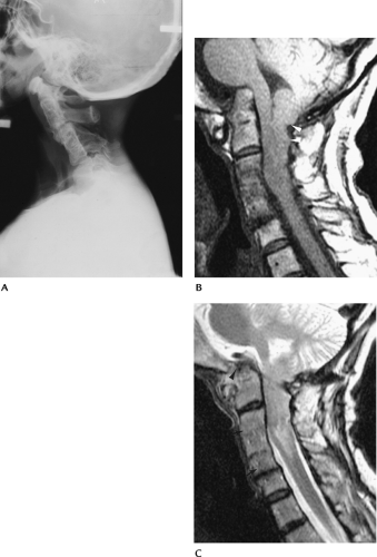 Spine Radiology Key