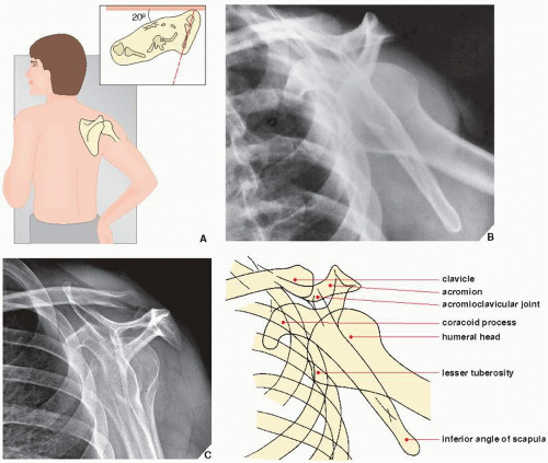 For the transscapular (or Y) projection of the shoulder girdle, the patient...