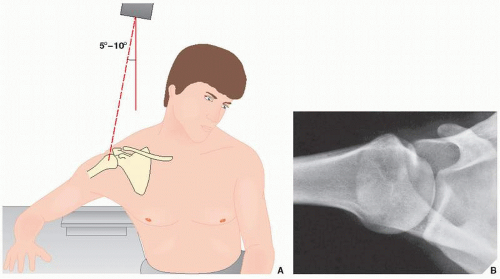 For the axillary view of the shoulder, the patient is seated at the side of...