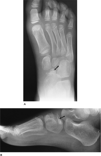 Foot Ankle And Calf Radiology Key 6872