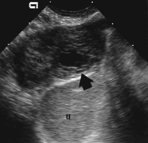 obstetric-ultrasound-first-trimester-radiology-key