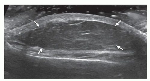 Soft Tissue Ultrasound 