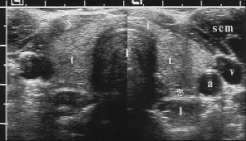 Thyroid, Parathyroid, and Neck Ultrasound | Radiology Key