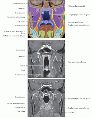 lateral pharyngeal space