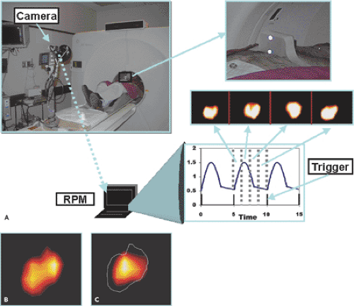 PET and PET-CT Imaging Protocols | Radiology Key