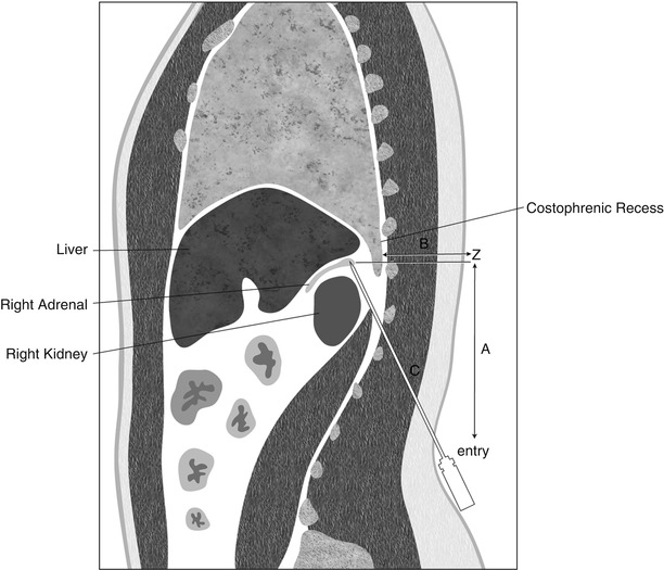 A162170_1_En_16_Fig3_HTML.jpg