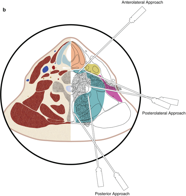 A162170_1_En_22_Fig1b_HTML.gif