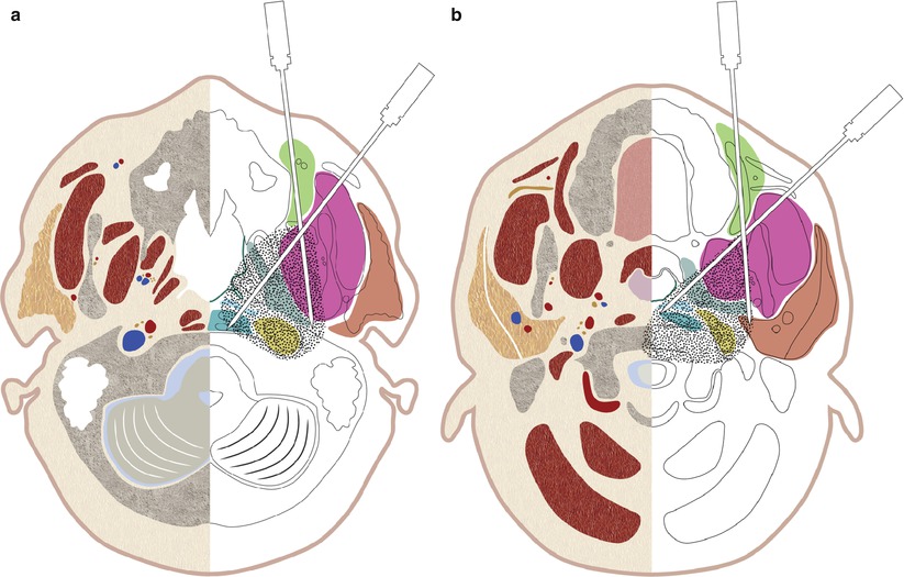 A162170_1_En_9_Fig9_HTML.jpg