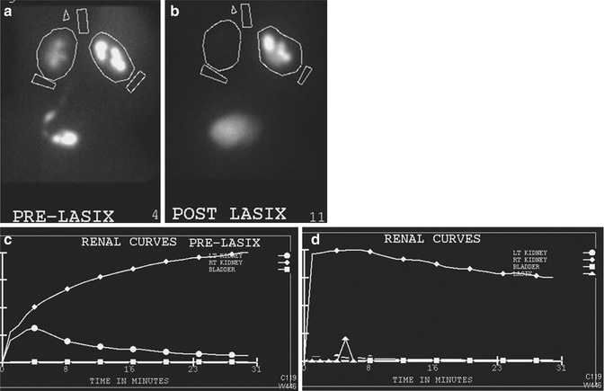 A217843_1_En_10_Fig3_HTML.jpg