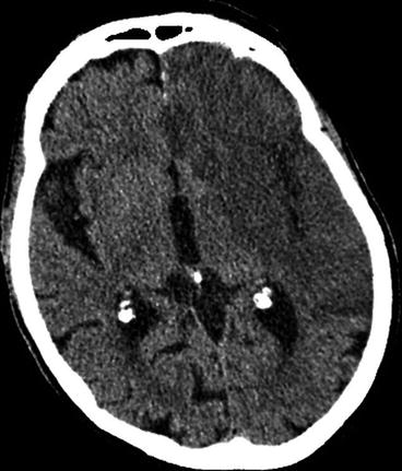 Computed Tomography Radiology Key