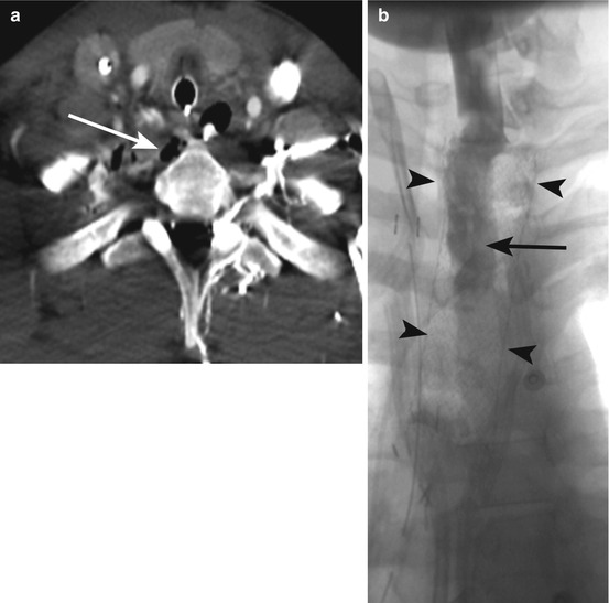 neck-injury-radiology-key