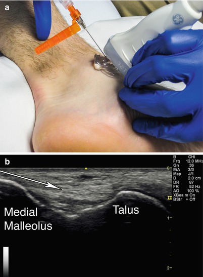 Foot and Ankle | Radiology Key