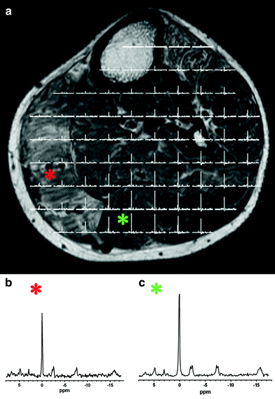 A307253_1_En_847_Fig9_HTML.gif