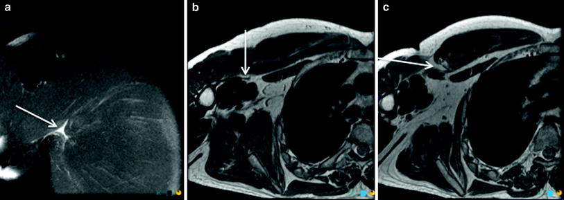 A307253_1_En_878_Fig9_HTML.jpg