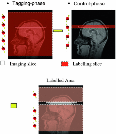 A307253_1_En_911_Fig13_HTML.gif