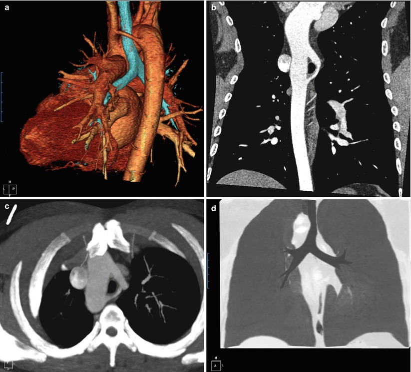 Pediatric Cardiac Imaging I: CT And MR Techniques | Radiology Key