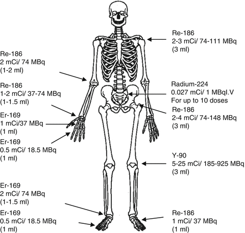 Basis of Therapeutic Nuclear Medicine | Radiology Key