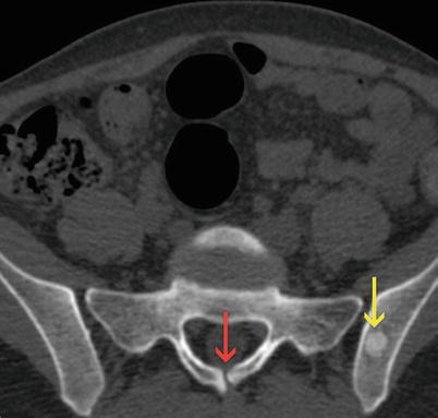 Incidental Findings | Radiology Key