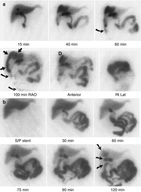 Digestive System 2: Liver and Biliary Tract | Radiology Key