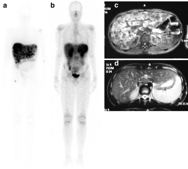 Neuroendocrine Tumors Radiology Key