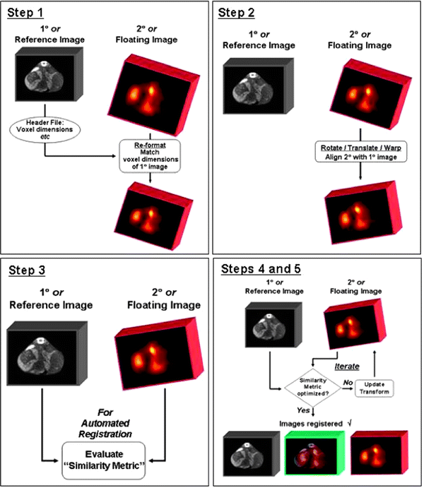Instrumentation | Radiology Key