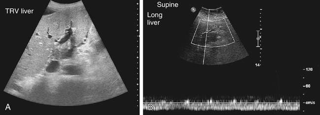 diffuse-liver-disease-radiology-key