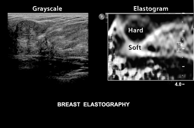 The Origins And Evolution Of Diagnostic Medical Sonography | Radiology Key