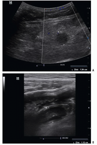 Pediatric Abdominal Emergencies | Radiology Key