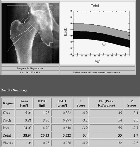 Skeletal System Scintigraphy | Radiology Key