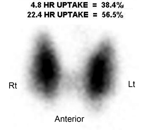 Endocrine Gland Scintigraphy Radiology Key