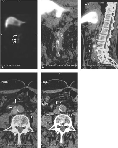 Following are the abstracts from the Third Annual Meeting of the Society  for Molecular Imaging. The nature of author relationships of financial  interests or affiliations with organizations with a direct and substantial