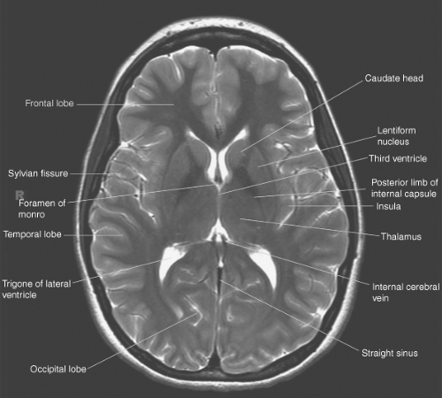 Introduction To Brain Imaging Radiology Key Introduction To Brain Imaging Radiology Key