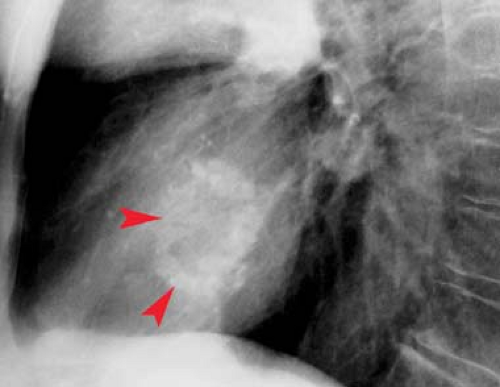Cardiac Anatomy Physiolgy And Imaging Modalities Radiology Key