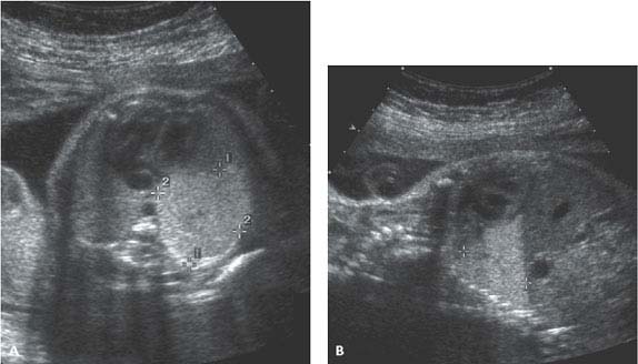 Thorax | Radiology Key