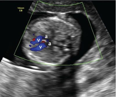 Normal Fetal Ultrasound Survey | Radiology Key