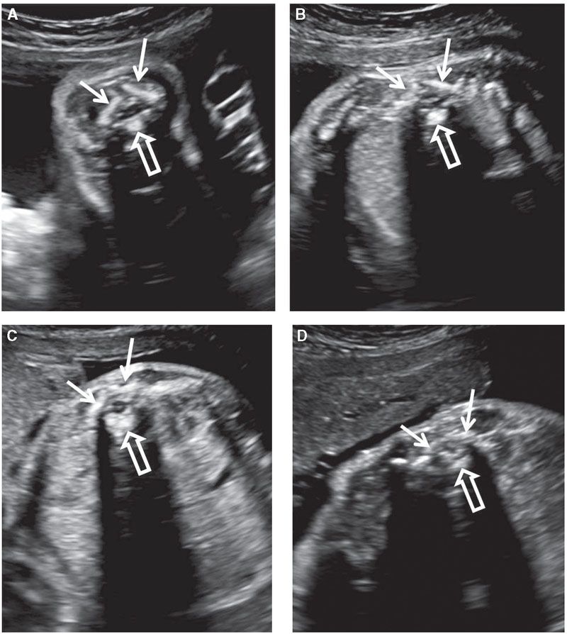 fetal-situs-with-images-fetal-ultrasound-sonography