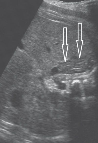 Genitourinary Abnormalities Radiology Key